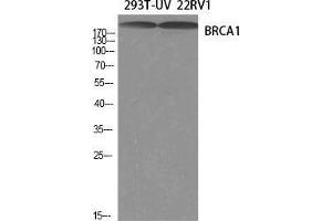 Western Blot (WB) analysis of specific cells using BRCA1 Polyclonal Antibody. (BRCA1 antibody  (Ser184, Ser186))