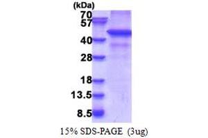 Ring Finger Protein 34 (RNF34) (AA 1-373) protein (His tag)