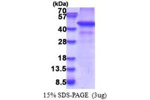 SDS-PAGE (SDS) image for Ring Finger Protein 34 (RNF34) (AA 1-373) protein (His tag) (ABIN5853359) (RNF34 Protein (AA 1-373) (His tag))