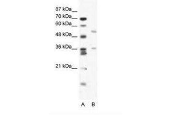 BTBD3 antibody  (AA 349-398)