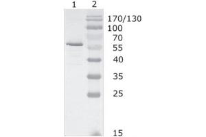 Western-Blot analysis of HIV-1 HAN subtype gag protein using HIV-1 p24 (05-001) antibody. (Human Immunodeficiency Virus Type 1 (HIV-1) antibody)