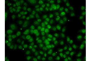 Immunofluorescence analysis of MCF-7 cells using ATMIN antibody (ABIN4902975). (ATM Interactor antibody)