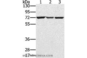 Western blot analysis of Hepg2, A172 and Raji cell, using SLC25A13 Polyclonal Antibody at dilution of 1:450 (slc25a13 antibody)