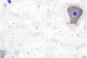 Immunohistochemistry analyzes of GAS3 antibody in paraffin-embedded human brain tissue. (PMP22 antibody)