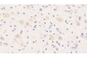 Detection of SCRN1 in Mouse Cerebrum Tissue using Polyclonal Antibody to Secernin 1 (SCRN1) (Secernin 1 antibody  (AA 2-414))