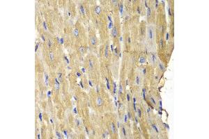 Immunohistochemistry (IHC) image for anti-Phospholipase C gamma 2 (PLCG2) (AA 1-300) antibody (ABIN3023145) (Phospholipase C gamma 2 antibody  (AA 1-300))