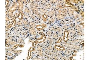 ABIN7093243 and ABIN7097260 at 1/100 staining Rat kidney tissue by IHC-P.