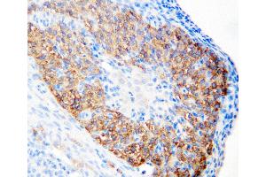 Anti-hCG receptor antibody, IHC(P) IHC(P): Rat Ovary Tissue (LHCGR antibody  (N-Term))