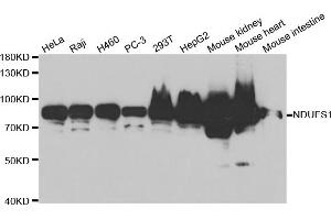 Western blot analysis of extracts of various cell lines, using NDUFS1 antibody (ABIN5971414) at 1/1000 dilution. (NDUFS1 antibody)