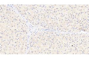 Detection of ITIH4 in Human Liver Tissue using Polyclonal Antibody to Inter Alpha-Globulin Inhibitor H4 (ITIH4) (ITIH4 antibody  (AA 273-424))