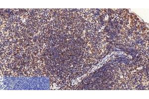 Immunohistochemistry of paraffin-embedded Mouse spleen tissue using CD2 Monoclonal Antibody at dilution of 1:200. (CD2 antibody)