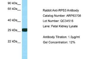 Western Blotting (WB) image for anti-Ribosomal Protein S3 (RPS3) (C-Term) antibody (ABIN971628) (RPS3 antibody  (C-Term))