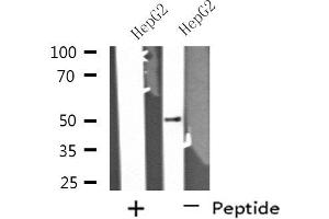 Western blot analysis of extracts from HepG2 cells using PPP4R1L antibody. (PPP4R1L antibody)