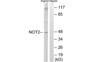 Western blot analysis of extracts from HepG2 cells, treated with starved (24hours), using CNOT2 (epitope around residue 101) antibody. (CNOT2 antibody  (Ser101))