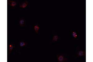 ABIN6269258 staining Hep G2 cells by IF/ICC. (GATA4 antibody  (Internal Region))