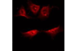 ABIN6267408 staining NIH-3T3 by IF/ICC. (PKC antibody  (pThr497))