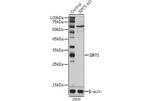 Western blot analysis of extracts of 293T cells, using SIRT5 antibody (ABIN6129331, ABIN6147798, ABIN6147799 and ABIN6221468) at 1:1000 dilution. (SIRT5 antibody  (AA 1-310))