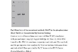 Western Blotting (WB) image for anti-Retinoblastoma 1 (RB1) (pThr821) antibody (ABIN3201013) (Retinoblastoma 1 antibody  (pThr821))