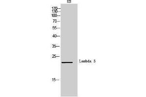 Western Blotting (WB) image for anti-Immunoglobulin lambda-Like Polypeptide 1 (IGLL1) (Internal Region) antibody (ABIN3181479) (IGLL1 antibody  (Internal Region))