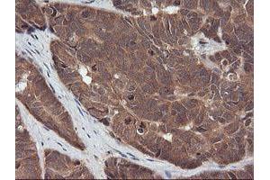 Image no. 3 for anti-Ras Association (RalGDS/AF-6) Domain Family (N-terminal) Member 8 (RASSF8) antibody (ABIN1500618)