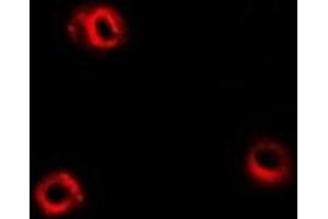Immunofluorescent analysis of APEH staining in Hela cells. (APEH antibody)