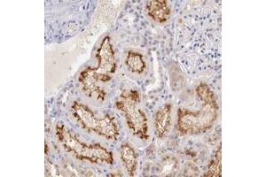Immunohistochemical staining of human kidney with XPNPEP2 polyclonal antibody  shows distinct membranous positivity in tubular cells at 1:50-1:200 dilution. (XPNPEP2 antibody)