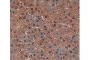 Used in DAB staining on fromalin fixed paraffin- embedded liver tissue (EED antibody  (AA 142-441))