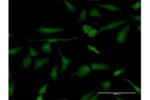 Immunofluorescence of purified MaxPab antibody to PSME3 on HeLa cell. (PSME3 antibody  (AA 1-254))