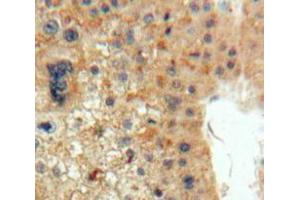 Used in DAB staining on fromalin fixed paraffin-embedded Liver tissue (EPO antibody  (AA 28-193))