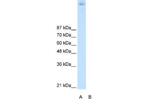 WB Suggested Anti-ZBTB38 Antibody Titration:  2. (ZBTB38 antibody  (N-Term))