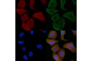 ABIN6259791 and ABIN6266850 staining Hela cells by IF/ICC. (ADCK1 antibody  (Internal Region))