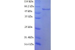 SDS-PAGE (SDS) image for Serpin H1 (SERPH) (AA 18-417) protein (His-SUMO Tag) (ABIN5710352) (Serpin H1 Protein (SERPH) (AA 18-417) (His-SUMO Tag))