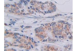 SHMT2 antibody  (AA 30-504)