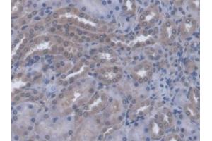 IHC-P analysis of Rat Kidney Tissue, with DAB staining. (A4GALT antibody  (AA 23-288))