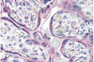 Anti-CXCR1 antibody  ABIN1048470 IHC staining of human placenta. (CXCR1 antibody  (Internal Region))
