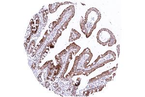 Duodenum exhibiting significant granular cytoplasmic SDHB staining in epithelial cells predominantly in the sub apical cell compartments (Recombinant SDHB antibody)