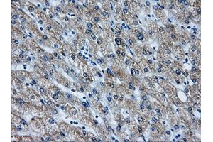 Immunohistochemistry (IHC) image for anti-Aldo-Keto Reductase Family 1, Member A1 (Aldehyde Reductase) (AKR1A1) antibody (ABIN1496542) (AKR1A1 antibody)