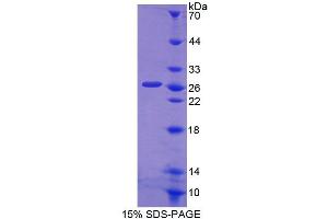Image no. 1 for Solute Carrier Family 15 (Oligopeptide Transporter), Member 1 (SLC15A1) (AA 383-584) protein (T7 tag,His tag) (ABIN4990220)