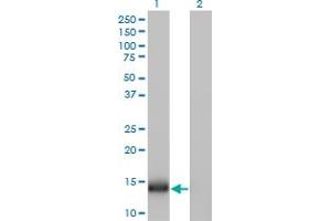Western Blot analysis of IFITM1 expression in transfected 293T cell line by IFITM1 monoclonal antibody (M01), clone 1F8. (IFITM1 antibody  (AA 1-125))