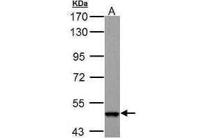 WB Image ABAT antibody detects ABAT protein by Western blot analysis. (ABAT antibody  (C-Term))