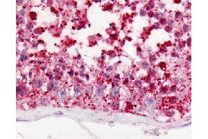 Immunohistochemical (Formalin/PFA-fixed paraffin-embedded sections) staining in human testis with GPR18 polyclonal antibody . (GPR18 antibody)