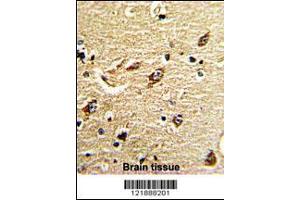 Formalin-fixed and paraffin-embedded human brain tissue reacted with ND5 Antibody , which was peroxidase-conjugated to the secondary antibody, followed by DAB staining. (MT-ND5 antibody  (C-Term))