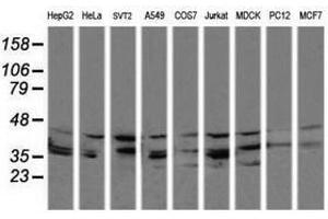 Image no. 1 for anti-Mitogen-Activated Protein Kinase Kinase 3 (MAP2K3) antibody (ABIN1499398) (MAP2K3 antibody)