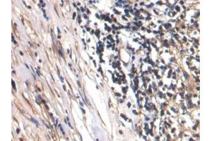 DAB staining on IHC-P; Samples: Human Lymph node Tissue (CTGF antibody  (AA 248-349))