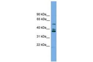 Image no. 1 for anti-Low Density Lipoprotein Receptor Class A Domain Containing 3 (LDLRAD3) (AA 143-192) antibody (ABIN6745022) (LDLRAD3 antibody  (AA 143-192))