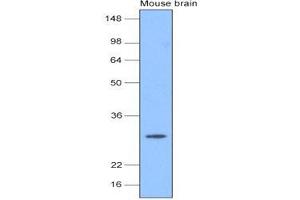 The extracts of mouse brain (20 ug) were resolved by SDS-PAGE, transferred to nitrocellulose membrane and probed with anti-human PGP9. (UCHL1 antibody  (AA 1-223))
