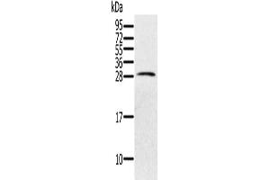 Gel: 12 % SDS-PAGE, Lysate: 40 μg, Lane: Human testis tissue, Primary antibody: ABIN7130619(PILRB Antibody) at dilution 1/200, Secondary antibody: Goat anti rabbit IgG at 1/8000 dilution, Exposure time: 40 seconds (PILRB antibody)