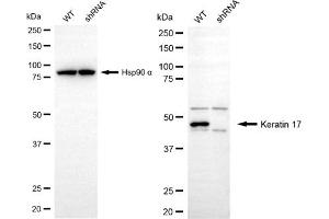 Western blotting analysis using keratin 17 antibody (ABIN7799171).