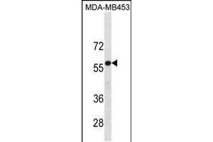 Western blot analysis in MDA-MB453 cell line lysates (35ug/lane). (UGT2B4 antibody  (N-Term))