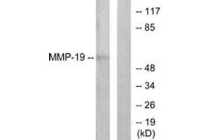 Western Blotting (WB) image for anti-Matrix Metallopeptidase 19 (MMP19) (AA 11-60) antibody (ABIN2889231) (MMP19 antibody  (AA 11-60))